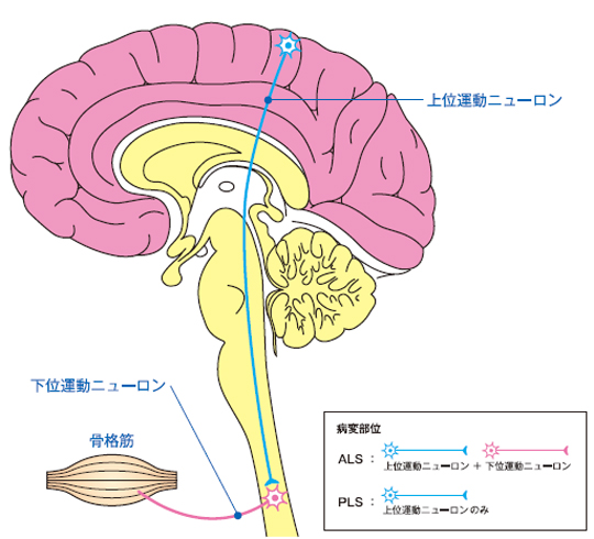 硬化 索 側 萎縮 筋 症 性